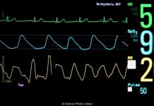 Soarta macabra a “cadavrelor a caror inima bate” sau “mortii vii” Soarta macabra a “cadavrelor a caror inima bate” sau “mortii vii”