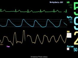 Soarta macabra a “cadavrelor a caror inima bate” sau “mortii vii” Soarta macabra a “cadavrelor a caror inima bate” sau “mortii vii”